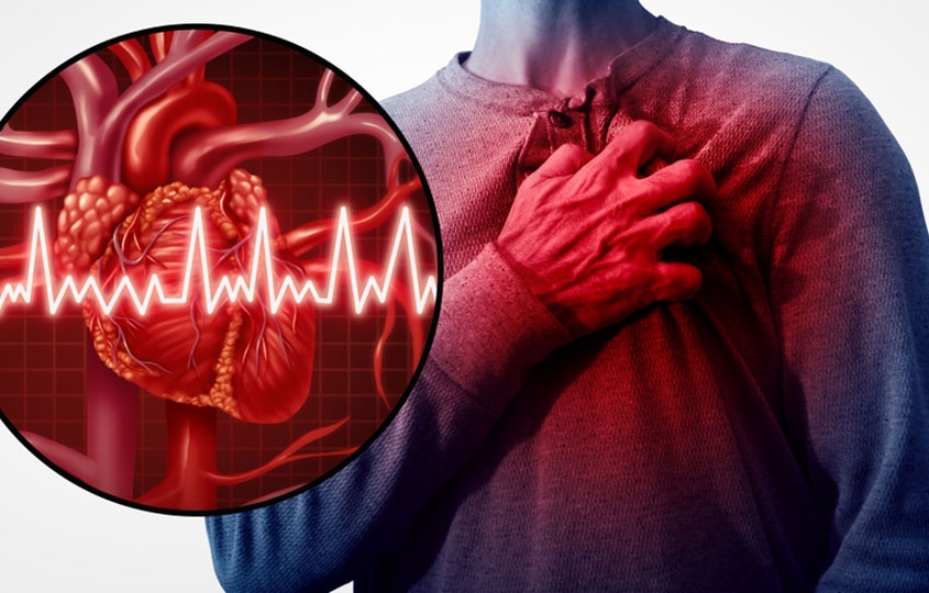 سکته قلبی|علائم سکته قلبی ونشانه حمله قلبی